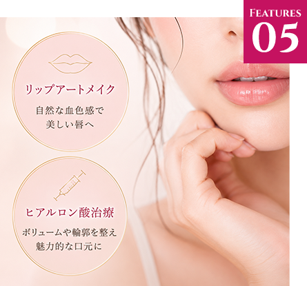 リップアート・ヒアルロン酸による口元デザイン